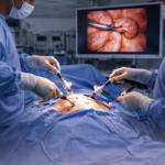 laparoscopic urology surgery