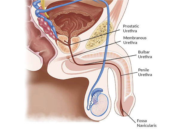 urethroplasty surgery in Bhopal