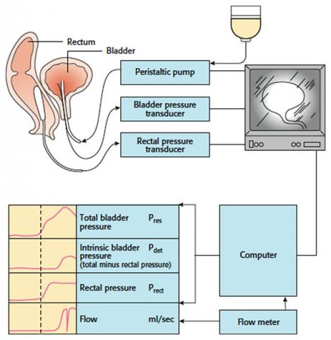 Urodynamics & Neurogenic Bladder Treatment in Bhopal